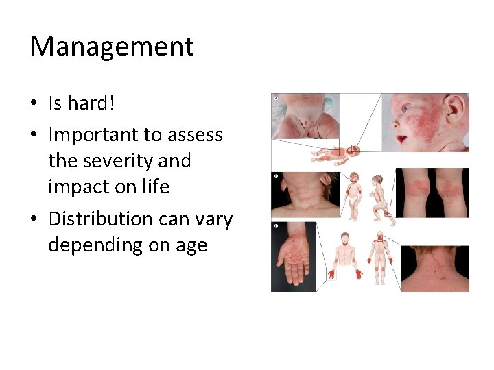 Management • Is hard! • Important to assess the severity and impact on life Management • Is hard! • Important to assess the severity and impact on life
