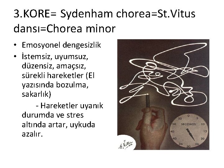 3. KORE= Sydenham chorea=St. Vitus dansı=Chorea minor • Emosyonel dengesizlik • İstemsiz, uyumsuz, düzensiz,