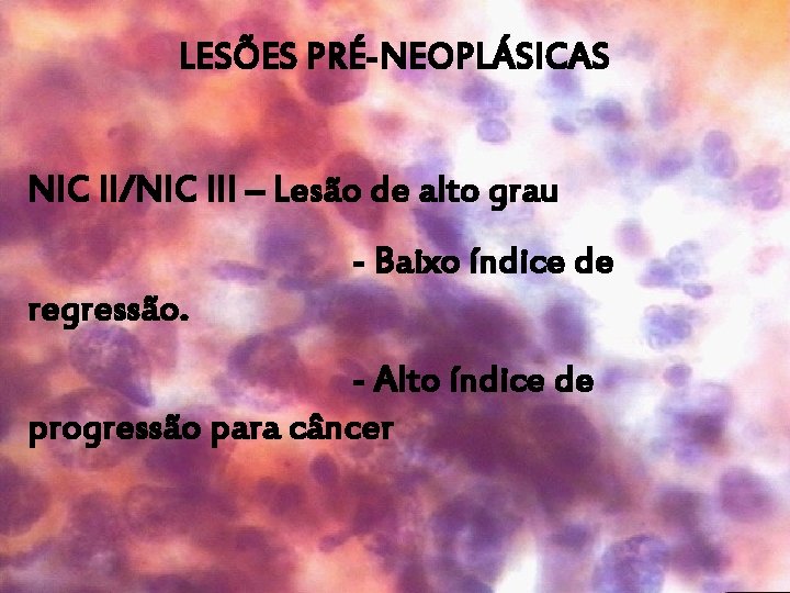 LESÕES PRÉ-NEOPLÁSICAS NIC II/NIC III – Lesão de alto grau - Baixo índice de