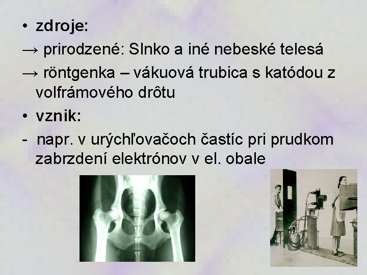  • zdroje: → prirodzené: Slnko a iné nebeské telesá → röntgenka – vákuová