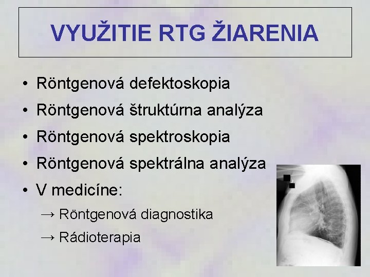 VYUŽITIE RTG ŽIARENIA • Röntgenová defektoskopia • Röntgenová štruktúrna analýza • Röntgenová spektroskopia •