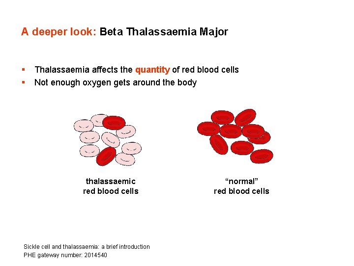 A deeper look: Beta Thalassaemia Major § § Thalassaemia affects the quantity of red