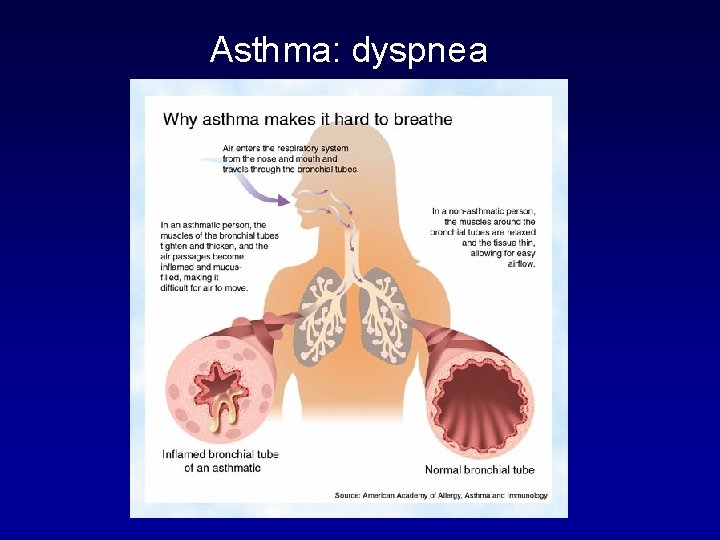 Asthma: dyspnea 