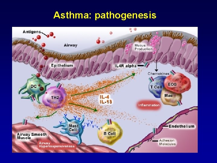 Asthma: pathogenesis 