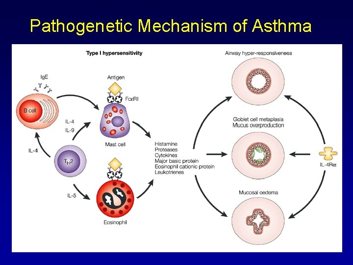 Pathophysiology Of Asthma Flowchart