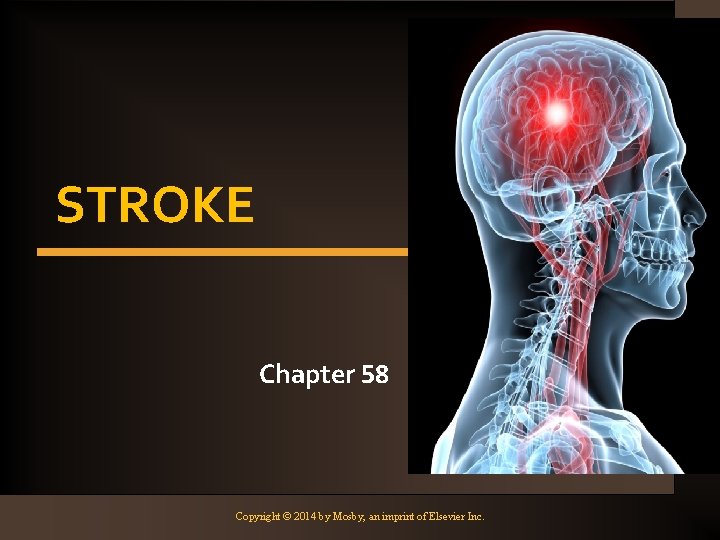 STROKE Chapter 58 Copyright © 2014 by Mosby, an imprint of Elsevier Inc. 