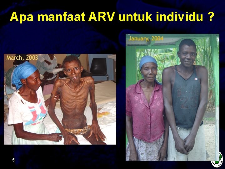 Apa manfaat ARV untuk individu ? 5 