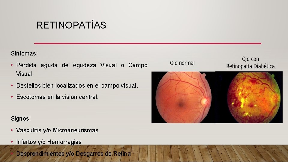 RETINOPATÍAS Síntomas: • Pérdida aguda de Agudeza Visual o Campo Visual • Destellos bien