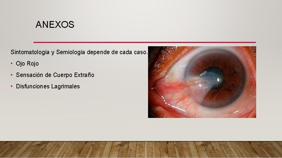 ANEXOS Sintomatología y Semiología depende de cada caso. • Ojo Rojo • Sensación de