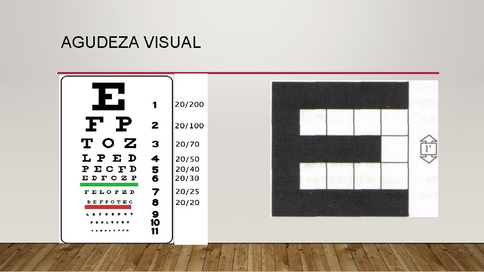 AGUDEZA VISUAL 