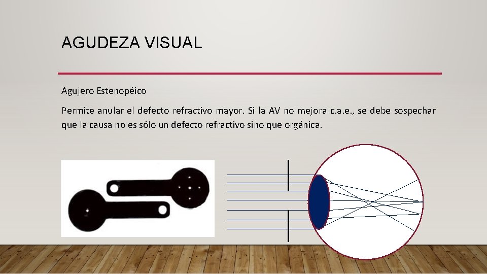 AGUDEZA VISUAL Agujero Estenopéico Permite anular el defecto refractivo mayor. Si la AV no