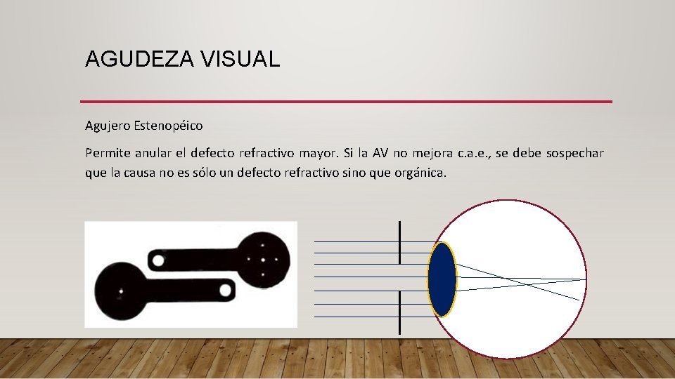 AGUDEZA VISUAL Agujero Estenopéico Permite anular el defecto refractivo mayor. Si la AV no