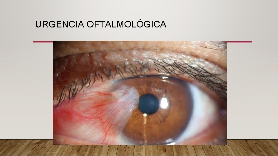 URGENCIA OFTALMOLÓGICA 