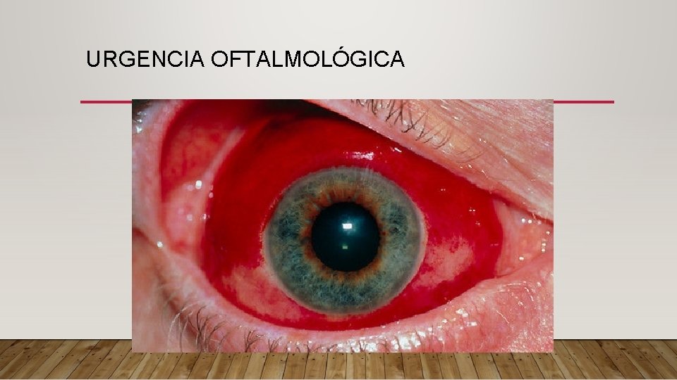 URGENCIA OFTALMOLÓGICA 
