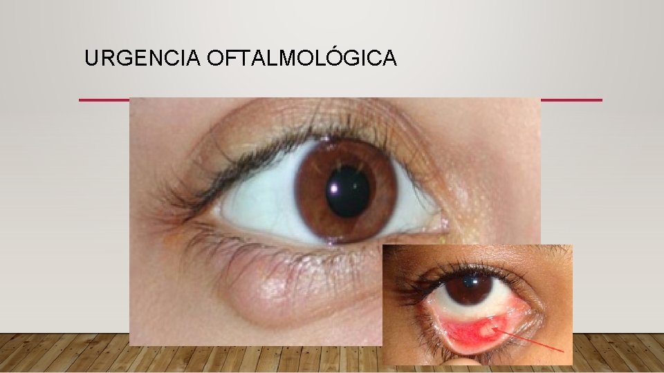 URGENCIA OFTALMOLÓGICA 