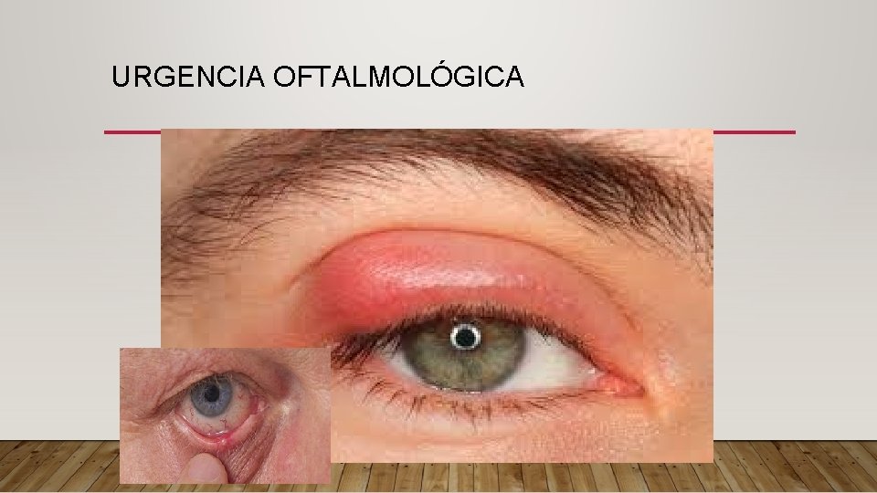 URGENCIA OFTALMOLÓGICA 