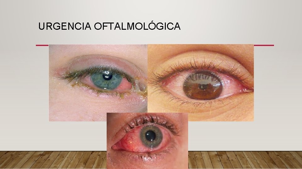URGENCIA OFTALMOLÓGICA 
