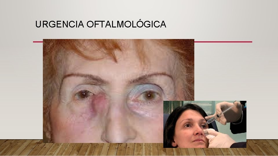 URGENCIA OFTALMOLÓGICA 