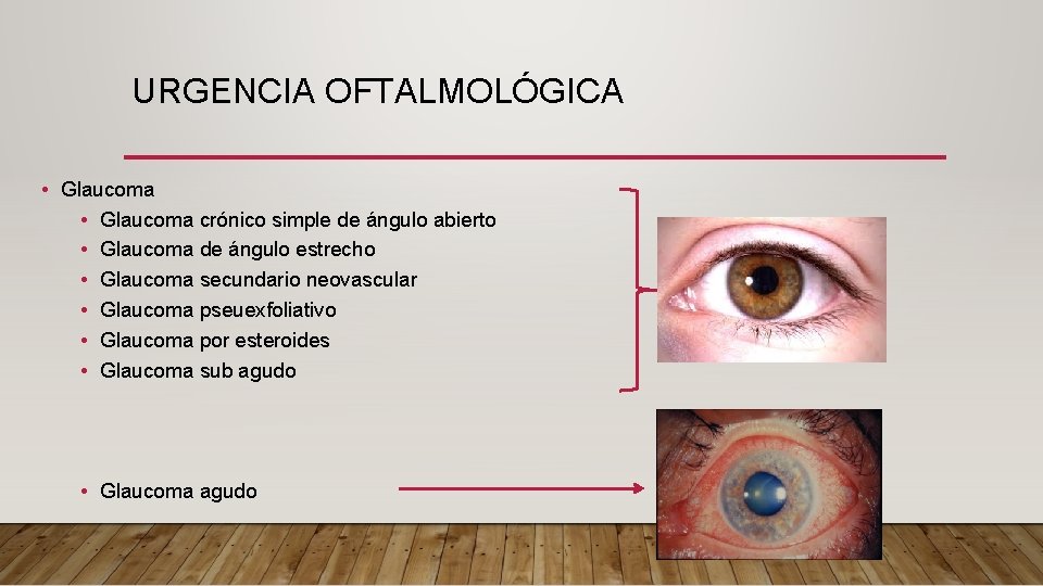 URGENCIA OFTALMOLÓGICA • Glaucoma crónico simple de ángulo abierto • Glaucoma de ángulo estrecho