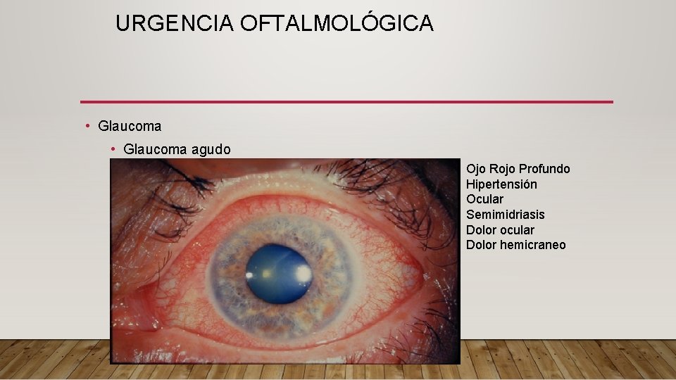 URGENCIA OFTALMOLÓGICA • Glaucoma agudo Ojo Rojo Profundo Hipertensión Ocular Semimidriasis Dolor ocular Dolor