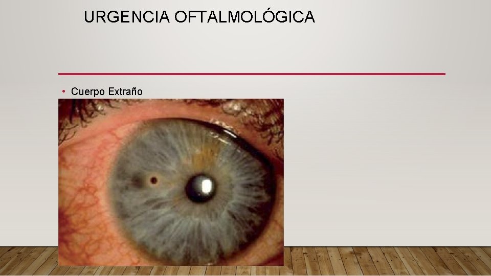 URGENCIA OFTALMOLÓGICA • Cuerpo Extraño 