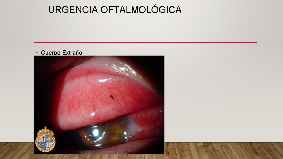 URGENCIA OFTALMOLÓGICA • Cuerpo Extraño 