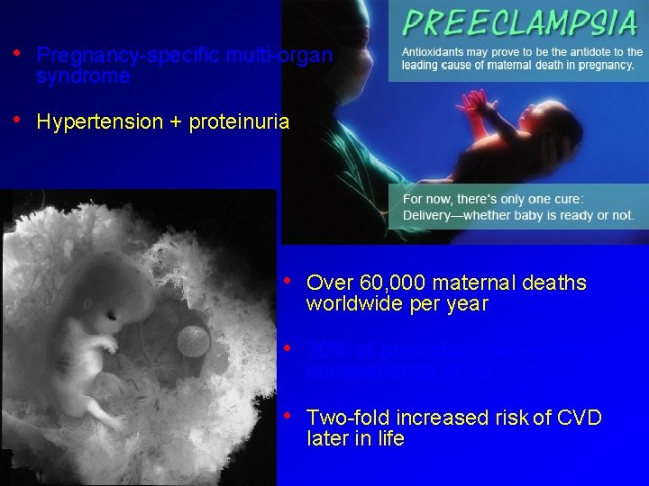  • Pregnancy-specific multi-organ syndrome • Hypertension + proteinuria • Over 60, 000 maternal