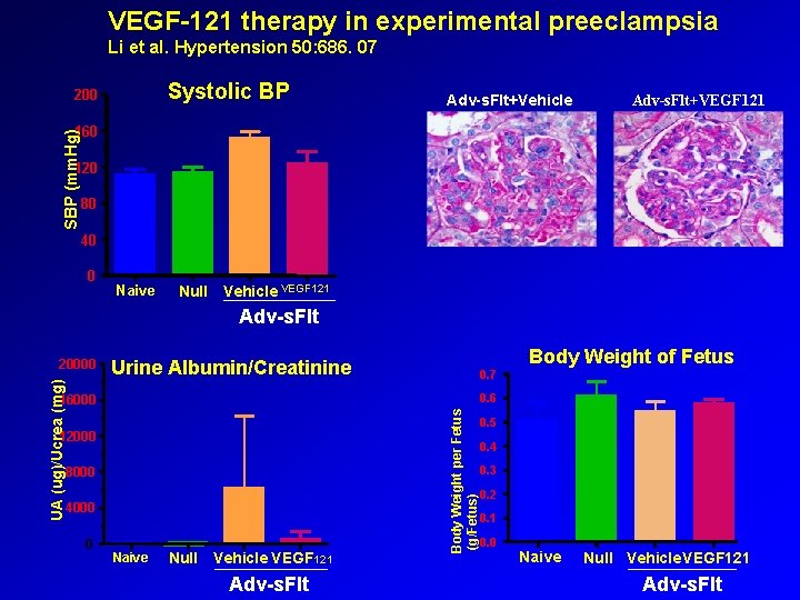 VEGF-121 therapy in experimental preeclampsia Li et al. Hypertension 50: 686. 07 200 Systolic