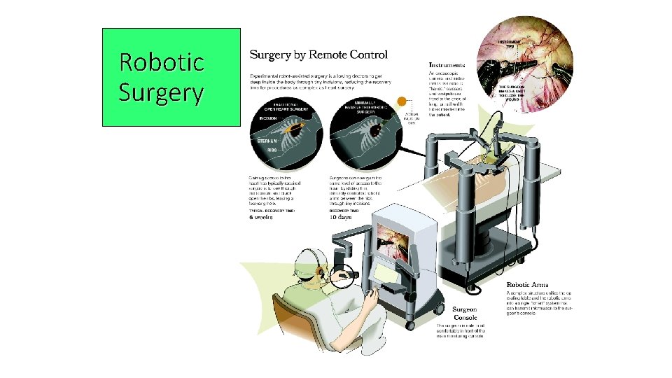 Robotic Surgery 