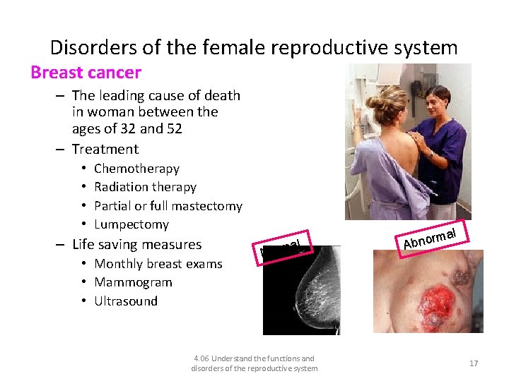 Disorders of the female reproductive system Breast cancer – The leading cause of death