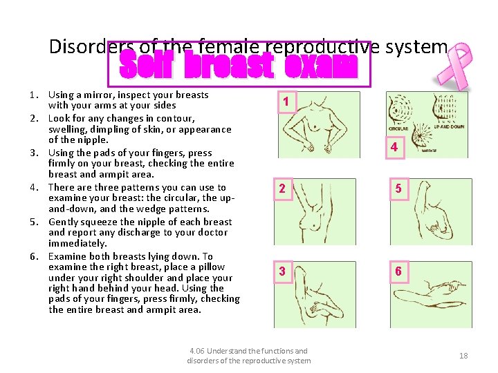 Disorders of the female reproductive system Self breast exam 1. Using a mirror, inspect
