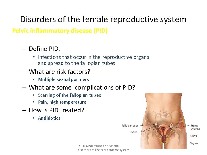 Disorders of the female reproductive system Pelvic inflammatory disease (PID) – Define PID. •