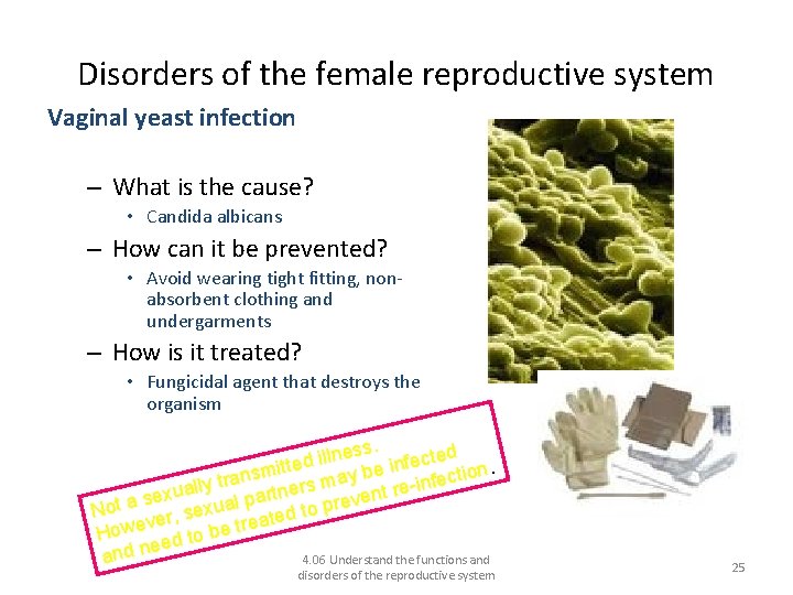 Disorders of the female reproductive system Vaginal yeast infection – What is the cause?