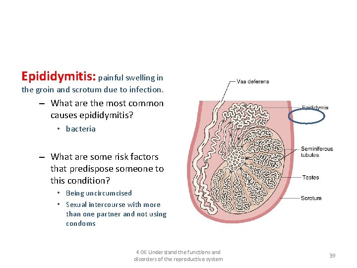 Disorders of the male reproductive system and their treatments Epididymitis: painful swelling in the