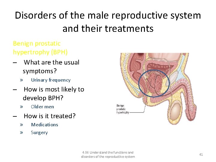 Disorders of the male reproductive system and their treatments Benign prostatic hypertrophy (BPH) –
