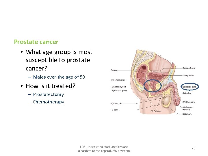 Disorders of the male reproductive system and their treatments Prostate cancer • What age