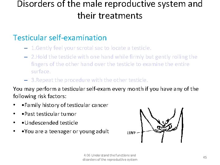 Disorders of the male reproductive system and their treatments Testicular self-examination – 1. Gently