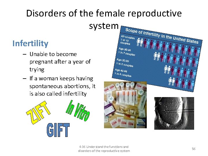 Disorders of the female reproductive system Infertility – Unable to become pregnant after a