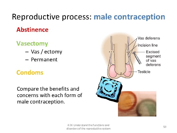 Reproductive process: male contraception Abstinence Vasectomy – Vas / ectomy – Permanent Condoms Compare