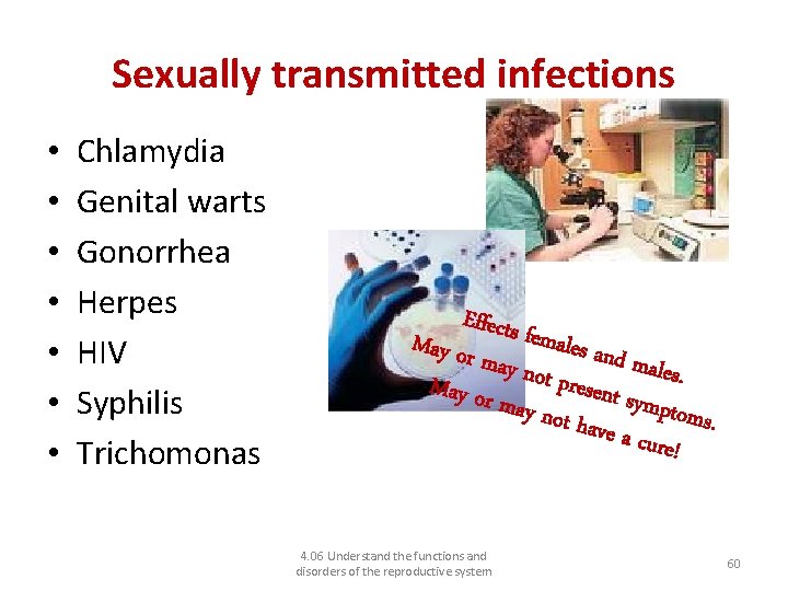 Sexually transmitted infections • • Chlamydia Genital warts Gonorrhea Herpes HIV Syphilis Trichomonas Effects
