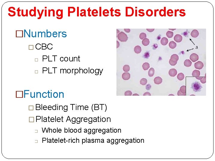 Studying Platelets Disorders �Numbers � CBC � � PLT count PLT morphology �Function �