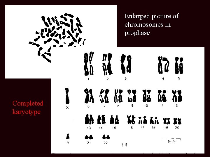 Enlarged picture of chromosomes in prophase Completed karyotype 