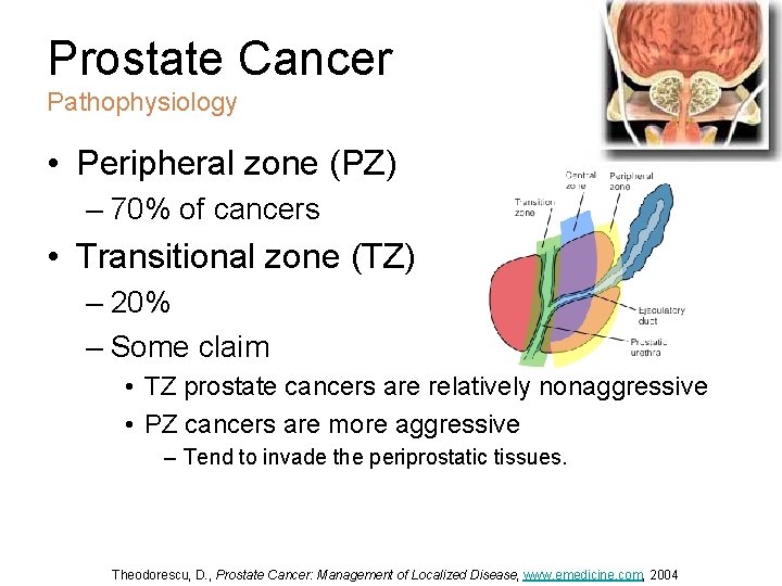 emedicine prostate cancer
