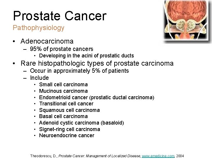 emedicine prostate cancer screening