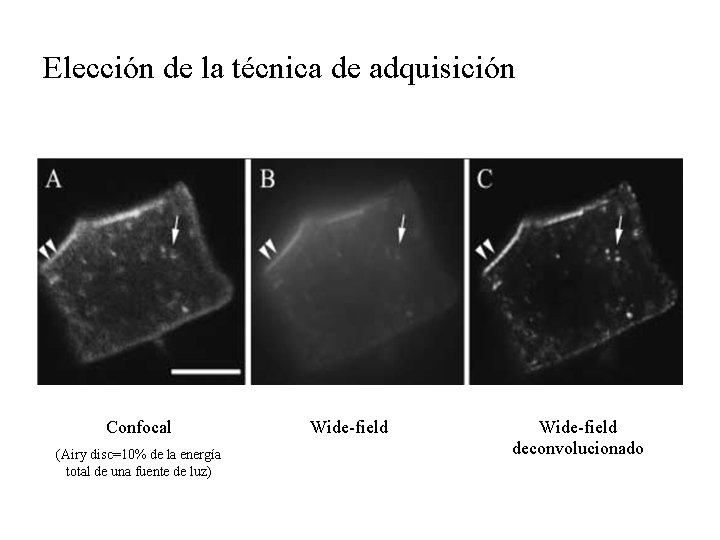 Elección de la técnica de adquisición Confocal (Airy disc=10% de la energía total de