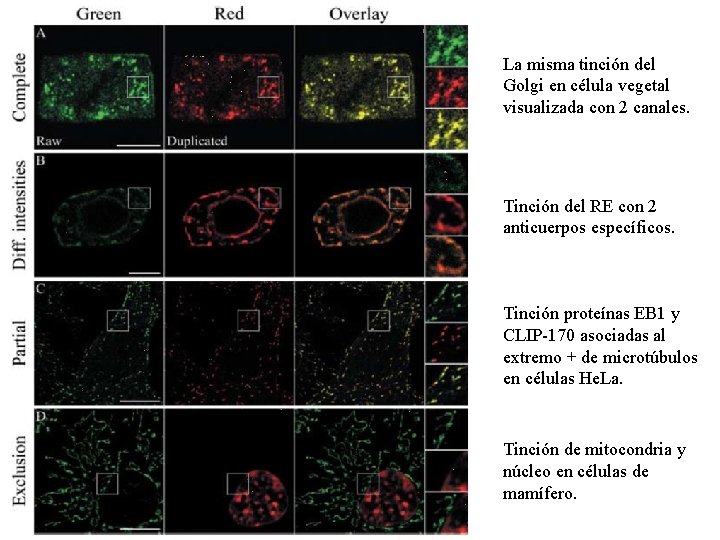 La misma tinción del Golgi en célula vegetal visualizada con 2 canales. Tinción del