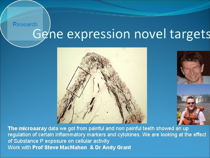 Gene expression novel targets The microaaray data we got from painful and non painful