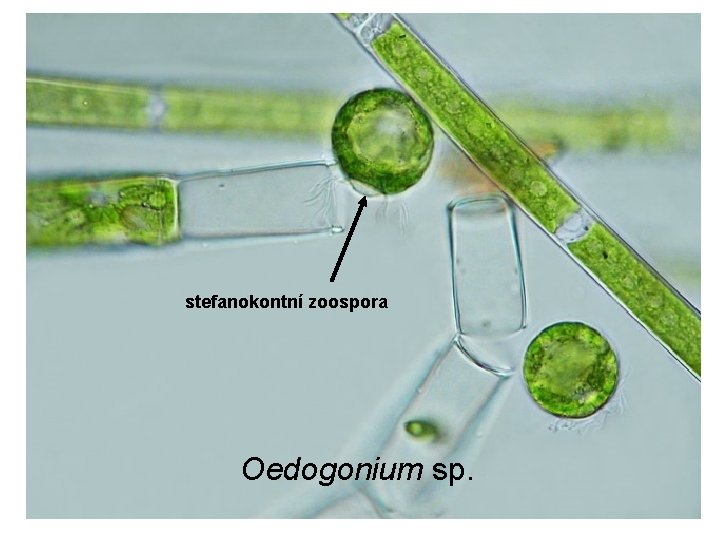 stefanokontní zoospora Oedogonium sp. 
