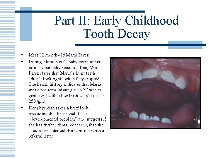 Part II: Early Childhood Tooth Decay w w w Meet 12 month-old Maria Perez.