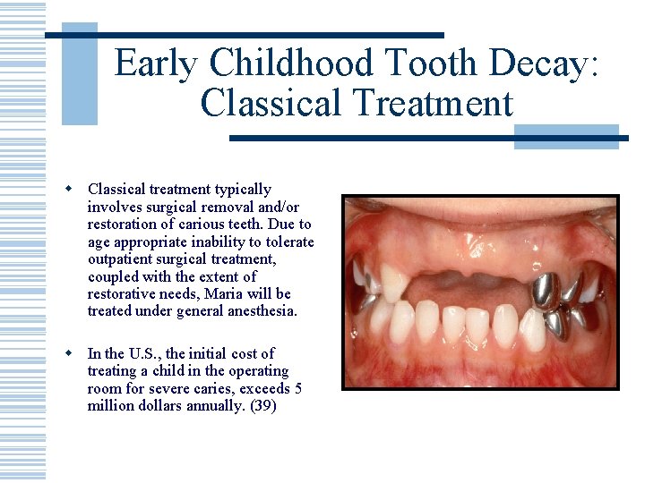 Early Childhood Tooth Decay: Classical Treatment w Classical treatment typically involves surgical removal and/or